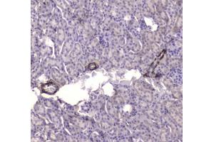 IHC testing of FFPE mouse kidney tissue with CKB antibody at 1ug/ml. (CKB anticorps)