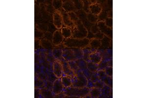 Immunofluorescence analysis of mouse kidney using SLC14 antibody (5991) at dilution of 1:100.