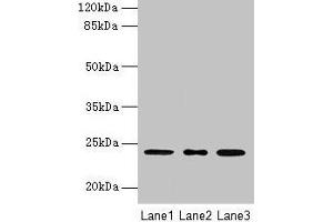 Western blot All lanes: MRPL58 antibody at 2 μg/mL Lane 1: A549 whole cell lysate Lane 2: Jurkat whole cell lysate Lane 3: K562 whole cell lysate Secondary Goat polyclonal to rabbit IgG at 1/10000 dilution Predicted band size: 24 kDa Observed band size: 24 kDa (Peptidyl-tRNA Hydrolase ICT1, Mitochondrial (AA 30-206) anticorps)