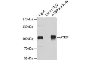 Immunoprecipitation analysis of 200 μg extracts of HeLa cells using 1 μg ATRIP antibody (ABIN1678799, ABIN3019346, ABIN3019347 and ABIN6220835).