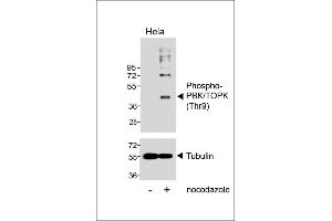 Western blot analysis of lysates from Hela cell line, untreated or treated with Nocodazole, 100 ng/mL, using Phospho-PBK/TOPK (Thr9) Antibody (upper) or Tubulin (lower). (PBK anticorps  (pThr9))