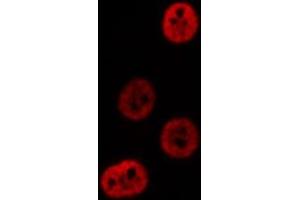 ABIN6276644 staining  NIH-3T3 cells by IF/ICC. (PSMA3 anticorps  (Internal Region))