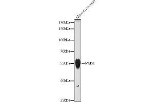 Western blot analysis of extracts of Mouse pancreas, using MEIS1 antibody (ABIN7268449) at 1:1000 dilution. (MEIS1 anticorps)