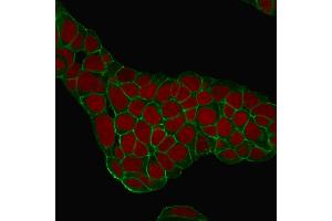 Confocal Immunofluorescence of MCF-7 cells EpCAM Mouse Monoclonal Antibody (EGP40/1384). (EpCAM anticorps  (Extracellular Domain))