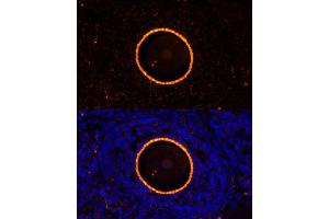 Immunofluorescence analysis of rat oophoroma cells using ZP2 antibody (ABIN6128965, ABIN6150534, ABIN6150535 and ABIN6214263) at dilution of 1:100.