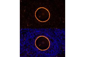 Immunofluorescence analysis of rat oophoroma cells using ZP2 antibody (ABIN6128965, ABIN6150534, ABIN6150535 and ABIN6214263) at dilution of 1:100. (ZP2 anticorps  (AA 651-745))