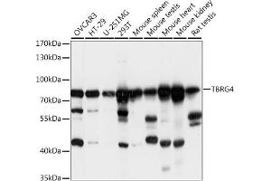 Western blot analysis of extracts of various cell lines, using TBRG4 antibody  at 1:1000 dilution. (TBRG4 anticorps  (AA 382-631))