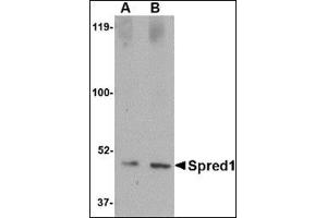 Western blot analysis of Spred1 in human brain tissue lysate with this product at (A) 1 and (B) 2 μg/ml. (SPRED1 anticorps  (Center))