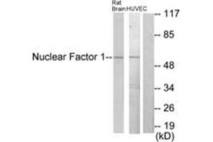 Western blot analysis of extracts from rat brain/HuvEc cells, using Nuclear Factor 1 Antibody. (Nuclear Factor 1 anticorps  (AA 11-60))