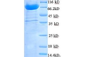 SDS-PAGE (SDS) image for Peptidoglycan Recognition Protein 2 (PGLYRP2) (AA 22-576) protein (His-SUMO Tag) (ABIN5711656)