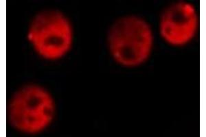 ABIN6277892 staining Hela cells by IF/ICC.
