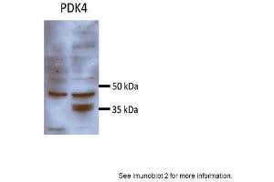 Sample Type: Huh7 HepG2 (50ug)Primary Antibody Dilution: 1:500 Image Submitted By: Partha KasturiUniversity of Kansas Medical Center (PDK4 anticorps  (N-Term))