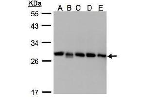 WB Image Sample(30μg whole cell lysate) A: 293T B: A431 , C: H1299 D: HeLa S3 , E: Hep G2 , 12% SDS PAGE antibody diluted at 1:1000 (ARHGDIB anticorps)