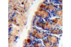 Used in DAB staining on fromalin fixed paraffin-embedded Intestine tissue (Mucosae Associated Epithelia Chemokine (AA 20-115) anticorps)