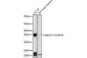 Western blot analysis of extracts of various cell lines, using Galectin 4/LG Rabbit mAb (ABIN1679347, ABIN3017979, ABIN3017980 and ABIN7101554) at 1:1000 dilution. (GAL4 anticorps)