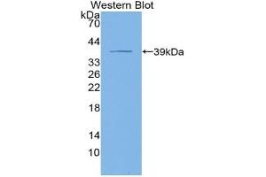 Detection of Recombinant KRT4, Human using Polyclonal Antibody to Cytokeratin 4 (CK4) (KRT4 anticorps  (AA 152-457))