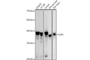 Western blot analysis of extracts of various cell lines, using SLP2 antibody (ABIN7270675) at 1:3000 dilution.