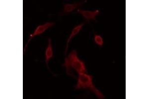 ABIN6266814 staining COLO205 cells by IF/ICC. (LRAT anticorps  (Internal Region))
