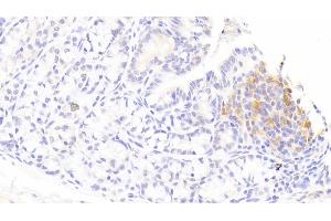 Detection of IL1RA in Rabbit Colon Tissue using Polyclonal Antibody to Interleukin 1 Receptor Antagonist (IL1RA) (IL1RN anticorps  (AA 26-177))