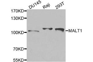 Western blot analysis of extracts of various cells, using MALT1 antibody. (MALT1 anticorps)