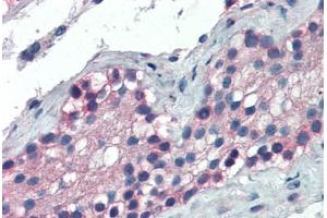 Human Testis (formalin-fixed, paraffin-embedded) stained with FOXE1 antibody ABIN337218 at 2. (FOXE1 anticorps  (AA 361-373))