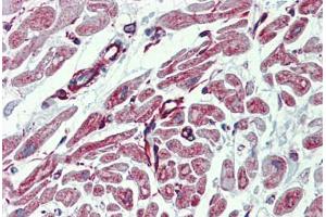Heart, Human: Formalin-Fixed, Paraffin-Embedded (FFPE) (PHACTR1 anticorps  (AA 468-517))