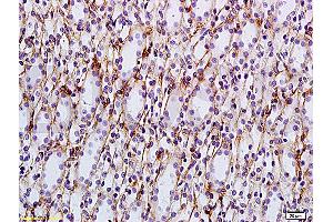 Formalin-fixed and paraffin embedded: rat kidney tissue labeled with Anti-AQP-2 Polyclonal Antibody, Unconjugated (ABIN1385618) at 1:200, followed by conjugation to the secondary antibody and DAB staining (AQP2 anticorps  (AA 101-200))
