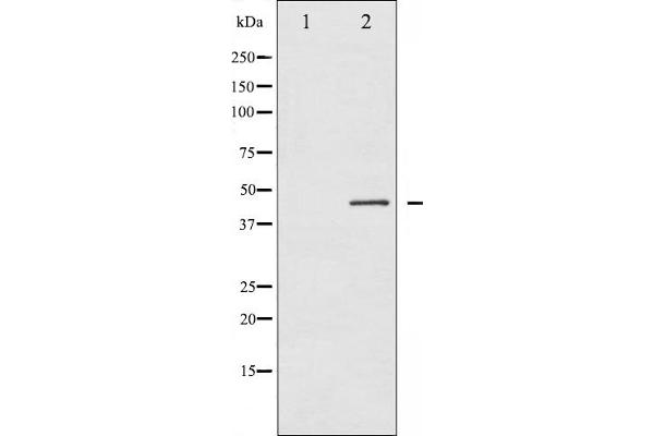 Connexin 43/GJA1 anticorps  (pSer368)