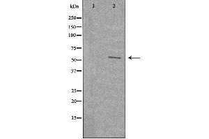 Western blot analysis of extracts from 3T3 cells using WASF3 antibody. (WASF3 anticorps  (Internal Region))