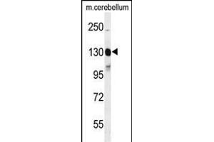 Western blot analysis of KIT Antibody  g in mouse cerebellum tissue lysates (35 μg/lane). (KIT anticorps  (AA 680-711))