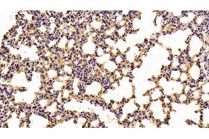Detection of NFKB3 in Mouse Lung Tissue using Polyclonal Antibody to Transcription Factor P65 (NFKB3)