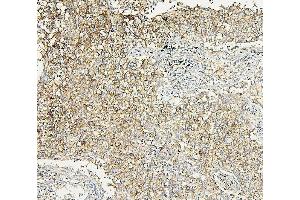 IHC analysis of ALDOA using anti-ALDOA antibody (ABIN7601907). (ALDOA anticorps  (AA 50-364))