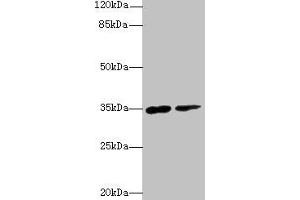 Western blot All lanes: RNF148 antibody at 6 μg/mL Lane 1: Hela whole cell lysate Lane 2: HepG2 whole cell lysate Secondary Goat polyclonal to rabbit IgG at 1/10000 dilution Predicted band size: 35 kDa Observed band size: 35 kDa (RNF148 anticorps  (AA 208-305))