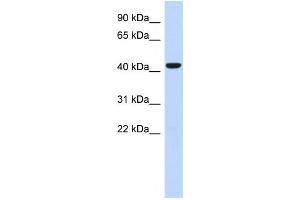 Western Blotting (WB) image for anti-Sphingomyelin Synthase 2 (SGMS2) antibody (ABIN2459622) (Sphingomyelin Synthase 2 anticorps)