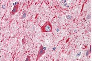 ABIN184877 (5µg/ml) staining of paraffin embedded Human Cortex. (PRDM11 anticorps  (C-Term))