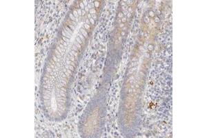 Immunohistochemistry (Formalin/PFA-fixed paraffin-embedded sections) of human appendix with PLOD3 polyclonal antibody  shows moderate cytoplasmic positivity in glandular cells.