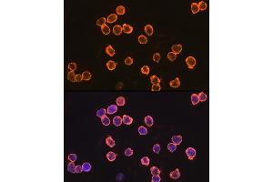 Immunofluorescence analysis of THP-1 cells using EMR1 Rabbit pAb (ABIN3021857, ABIN3021858, ABIN3021859 and ABIN6216234) at dilution of 1:100 (40x lens).