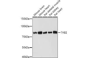 Western blot analysis of extracts of various cell lines, using T antibody (ABIN6131433, ABIN6148797, ABIN6148798 and ABIN6225202) at 1:1000 dilution. (TAB2 anticorps  (AA 350-693))