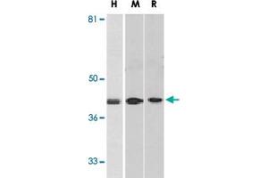 Western blot analysis of DAPK2 in A-431 (H), mouse spleen (M), and rat kidney (R) lysates with DAPK2 polyclonal antibody  at 1 ug/mL . (DAPK2 anticorps  (C-Term))