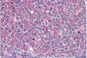 ABIN570765 (3. (ICOS anticorps  (Internal Region))