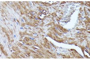 Immunohistochemistry of paraffin-embedded Mouse heart using N-WASP Polyclonal Antibody at dilution of 1:100 (40x lens). (Neural Wiskott-Aldrich syndrome protein (WASL) anticorps)