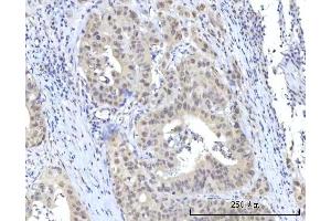 IHC analysis of RBM22 using anti-RBM22 antibody (ABIN7600268). (RBM22 anticorps  (AA 17-406))
