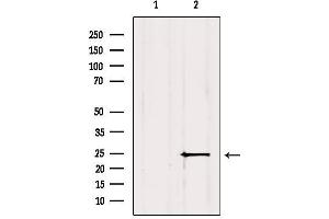 Western blot analysis of extracts from Mouse brain, using MIXL1 Antibody. (MIXL1 anticorps  (Internal Region))