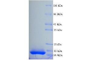 SDS-PAGE (SDS) image for Interleukin 15 (IL15) (AA 49-162) protein (His tag) (ABIN5713548)
