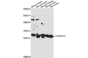 Western blot analysis of extracts of various cell lines, using TSPAN31 antibody. (TSPAN31 anticorps)