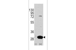 Western blot analysis of Latexin using rabbit polyclonal Latexin Antibody using 293 cell lysates (2 ug/lane) either nontransfected (Lane 1) or transiently transfected with the LXN gene (Lane 2).