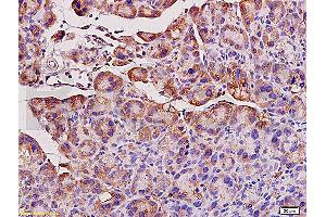 Formalin-fixed and paraffin embedded rat pancreas tissue labeled with Anti-ACE1 Polyclonal Antibody, Unconjugated (ABIN668631) at 1:200, followed by conjugation to the secondary antibody and DAB staining