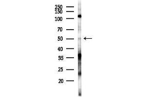 anti-Keratin 15 (KRT15) antibody