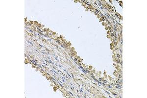 Immunohistochemistry of paraffin-embedded human prostate using MEMO1 antibody  at dilution of 1:100 (40x lens). (MEMO1 anticorps  (AA 1-297))