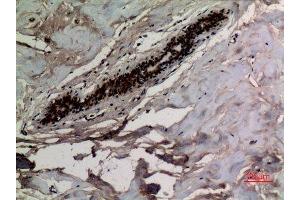 Immunohistochemistry (IHC) analysis of paraffin-embedded Human Breast, antibody was diluted at 1:100. (KRT8 anticorps  (acLys483))